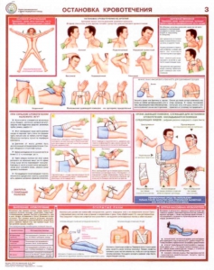 Плакат по оказанию первой медицинской помощи